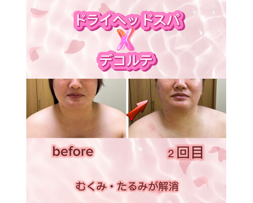 ヘッド