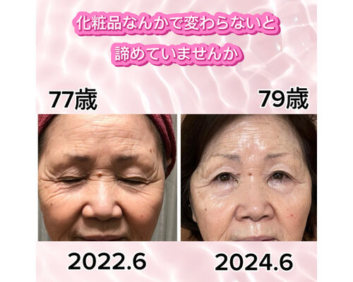 リアボーテ