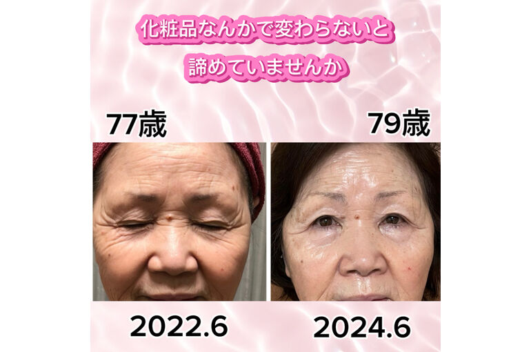 リアボーテ