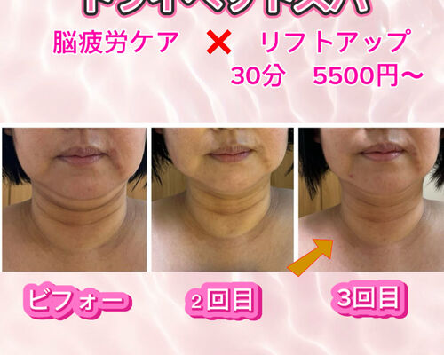 ヘッド