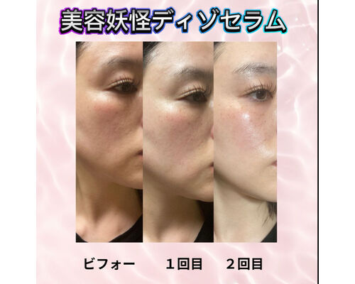 セラム