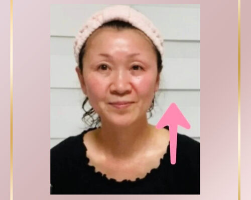 ファットセラム
