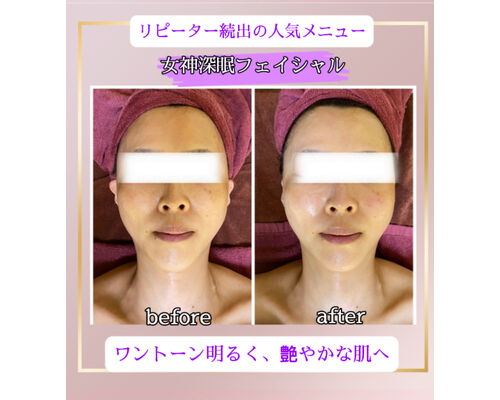 フェイシャル