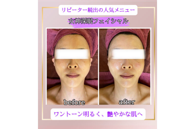 フェイシャル