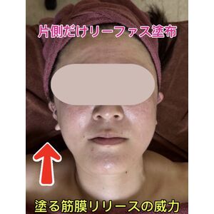 リーファス
