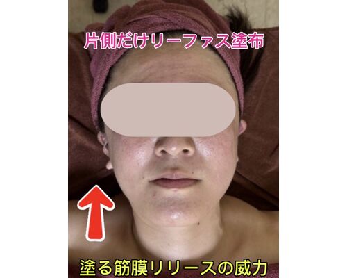 リーファス