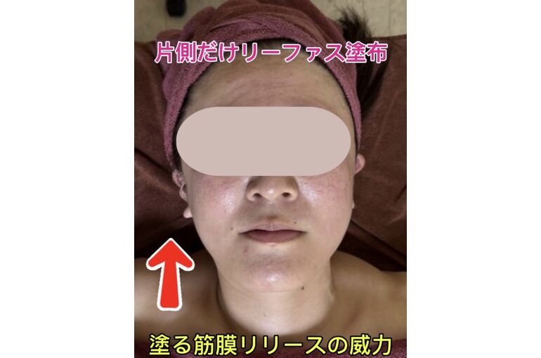 リーファス