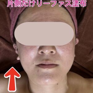 首肩こり