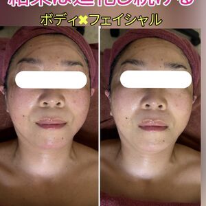 フェイシャル