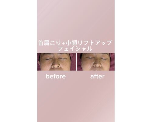 目元