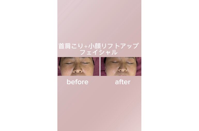 目元