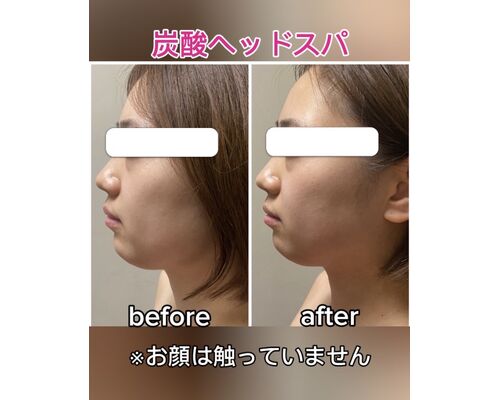 ヘッド