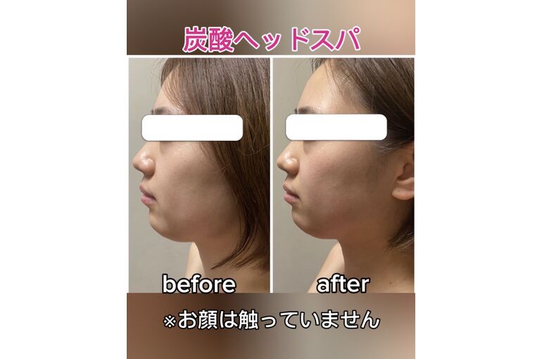 ヘッド