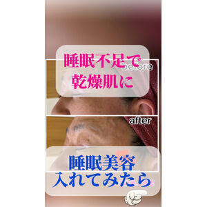 睡眠美容