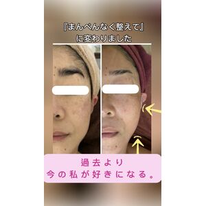 フェイシャル