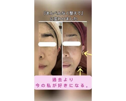 フェイシャル