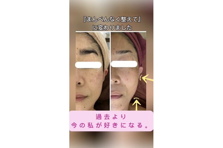 フェイシャル