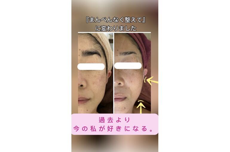 フェイシャル