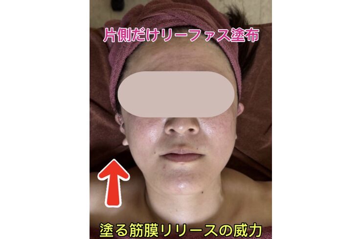 リーファス
