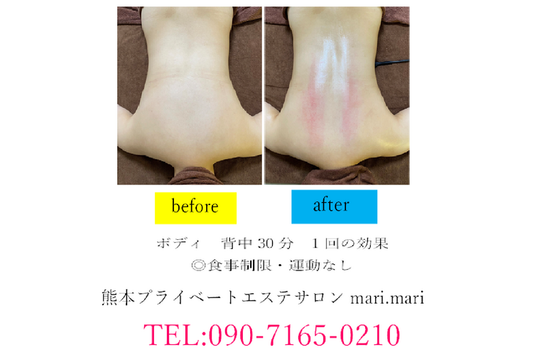 背中30分
