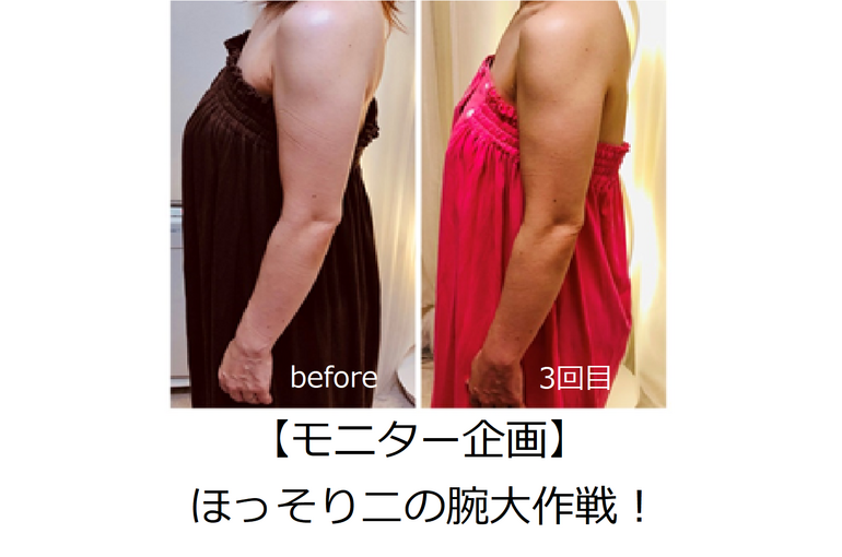 二の腕