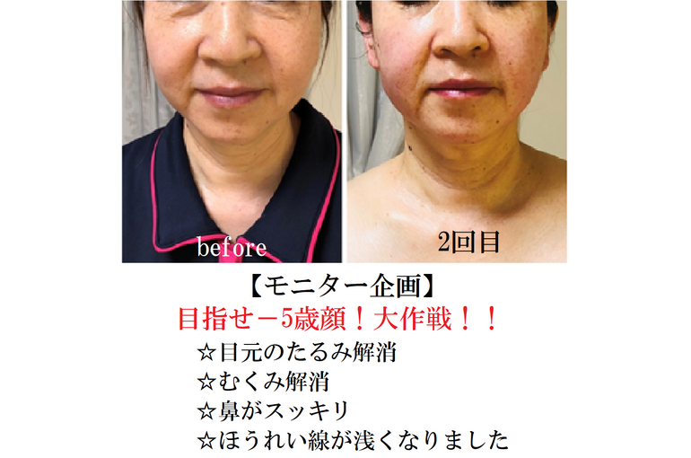 フェイシャル