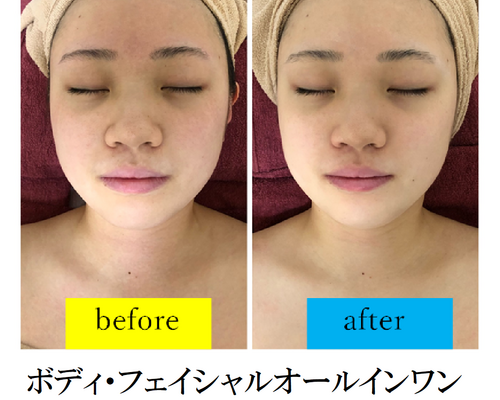 オールインワン